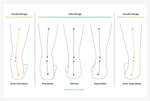 WHAT IS PRONATION, OVERPRONATION AND SUPINATION? – Sole Distribution